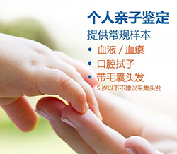 衢州如何私下做亲子鉴定，衢州血缘检测办理流程