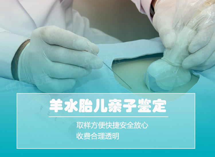 衢州羊水孕期亲子鉴定
